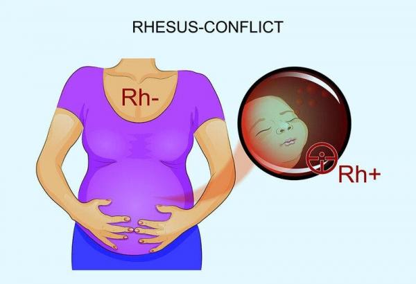 Yếu tố Rh trong nhóm máu của mẹ và ảnh hưởng tới thai kỳ (Phần cuối)